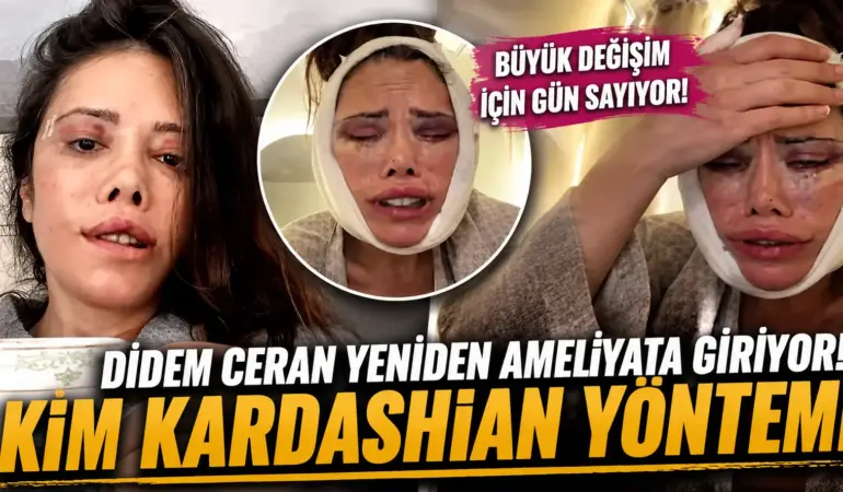 Didem Ceran Yine Ameliyat Masasında! Yeni Hedefi Kim Kardashian Görünümü