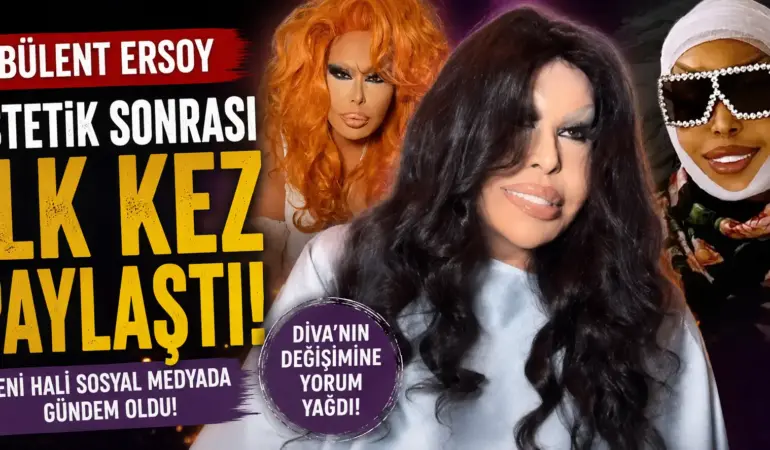 Bülent Ersoy’un Estetik Sonrası Hali Olay Oldu! Sosyal Medyada Yorum Yağdı
