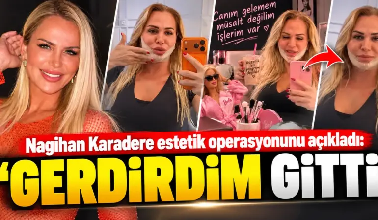 Survivor Nagihan Karadere’den estetik itirafı! Boyun ve yüzünü gerdirdi